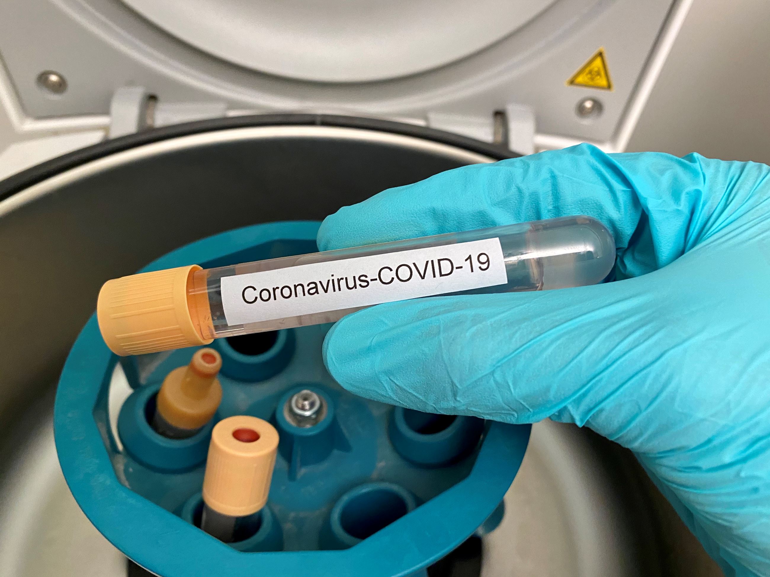 COVID word on test tube